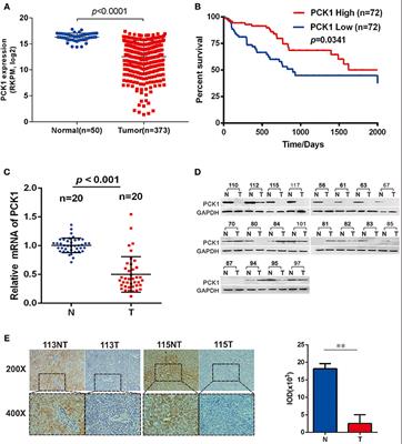 PCK1 Downregulation Promotes TXNRD1 Expression and Hepatoma Cell Growth via the Nrf2/Keap1 Pathway